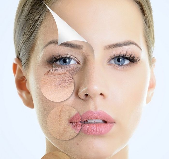 Căng Da Mặt Bằng Chỉ Collagen Bao Nhiêu Tiền 3